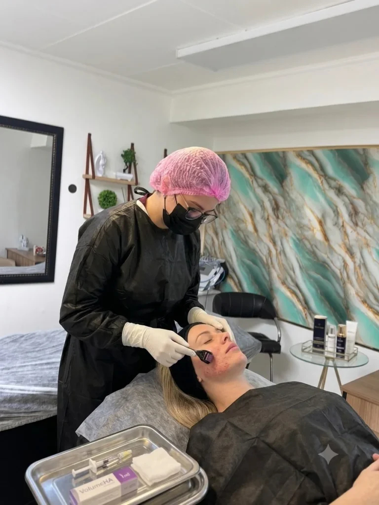 Procedimento de microagulhamento facial realizado por profissional habilitada na Clínica Phorma